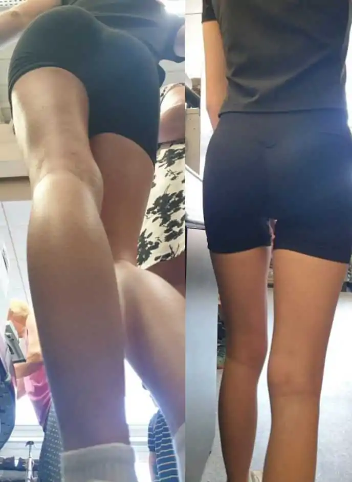 French Teen VPL